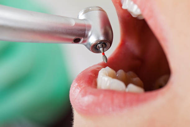 Best Emergency Dental Services for Seniors in Auburn, MI